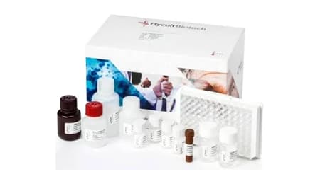 Human IL-6 ELISA Kit